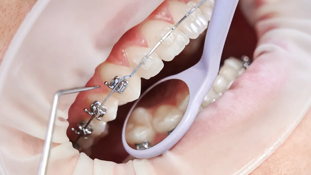 MSc in Orthodontics (Full Time 15 Months) at the College of Medicine & Dentistry, Birmingham